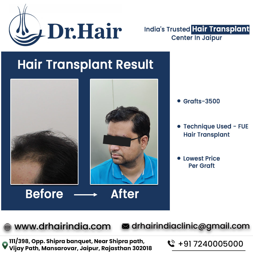 Before & After - Case 1